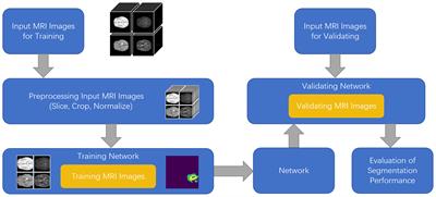 MM-UNet: A multimodality brain tumor segmentation network in MRI images